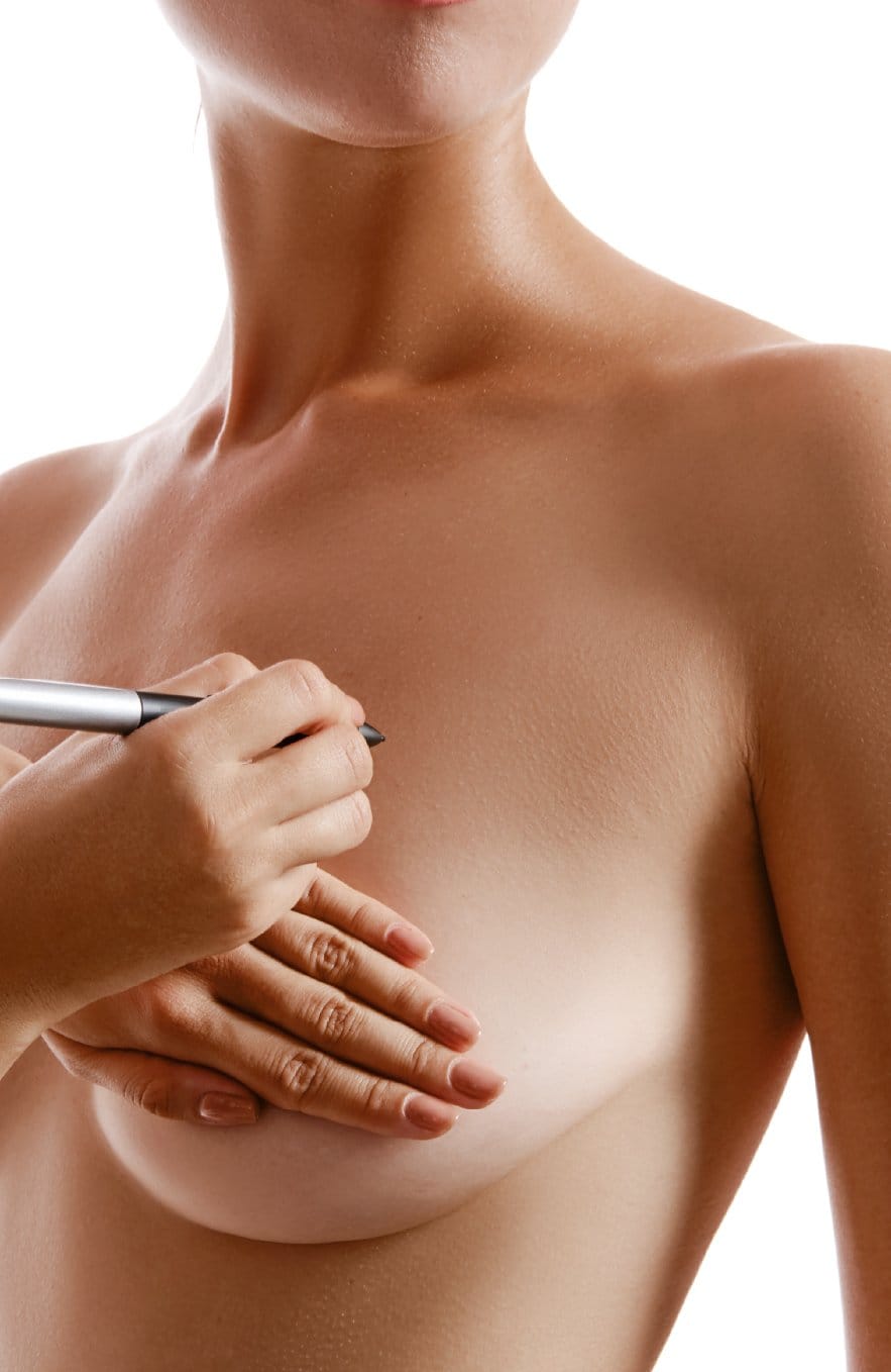 Lipoescultura Híbrida + Pexia Mamaria con Implantes