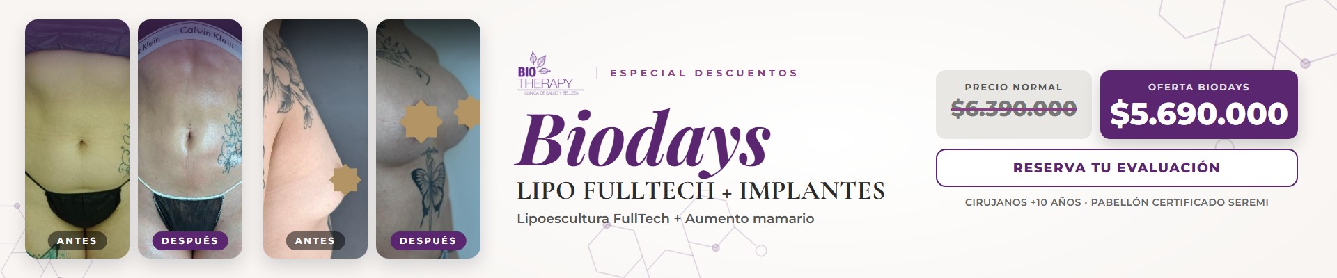 Biodays: Lipoescultura FullTech + implantes mamarios, antes y después, oferta $5.690.000 (precio normal $6.390.000)