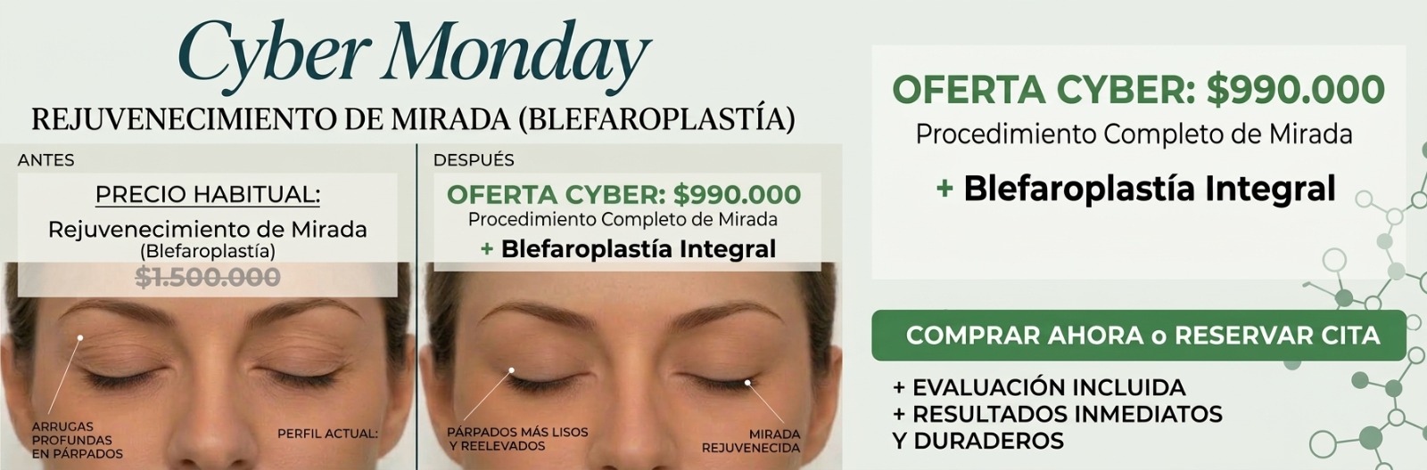 Cyber Monday Rejuvenecimiento de mirada (Blefaroplastía): antes y después de los párpados