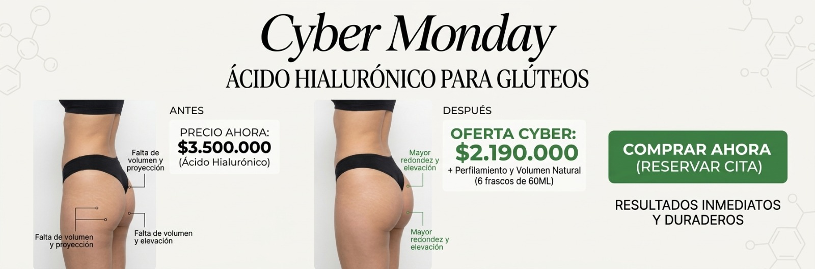 Cyber Monday Ácido Hialurónico para glúteos: antes y después con mayor redondez y elevación