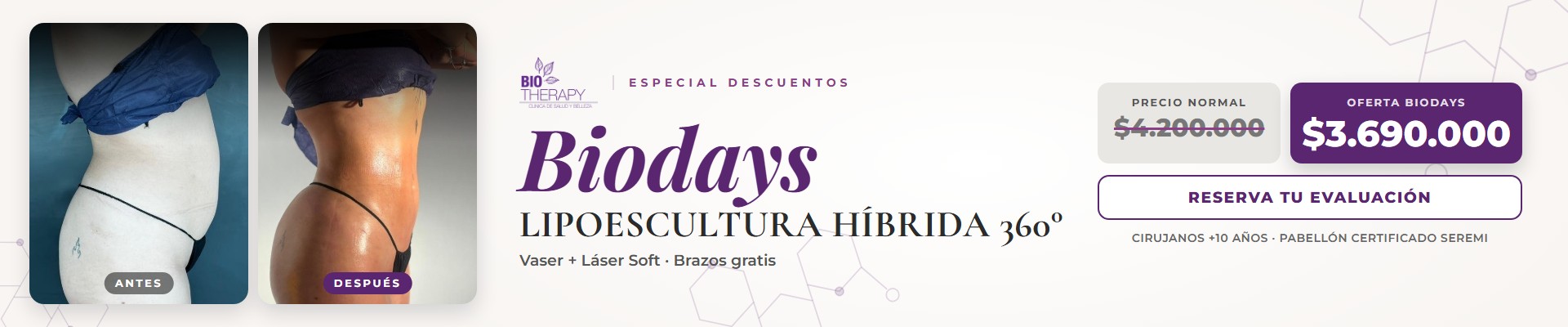 Biodays: Lipoescultura Híbrida 360° Vaser + Láser Soft con brazos gratis, antes y después, oferta $3.690.000 (precio normal $4.200.000)